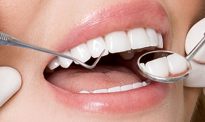 răng sứ thẩm mỹ đẹp